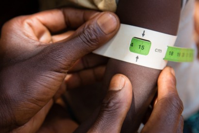 Measuring a child’s upper arm circumference helps gauge her nutritional status. Photo: Joe Molieri / Bread for the World