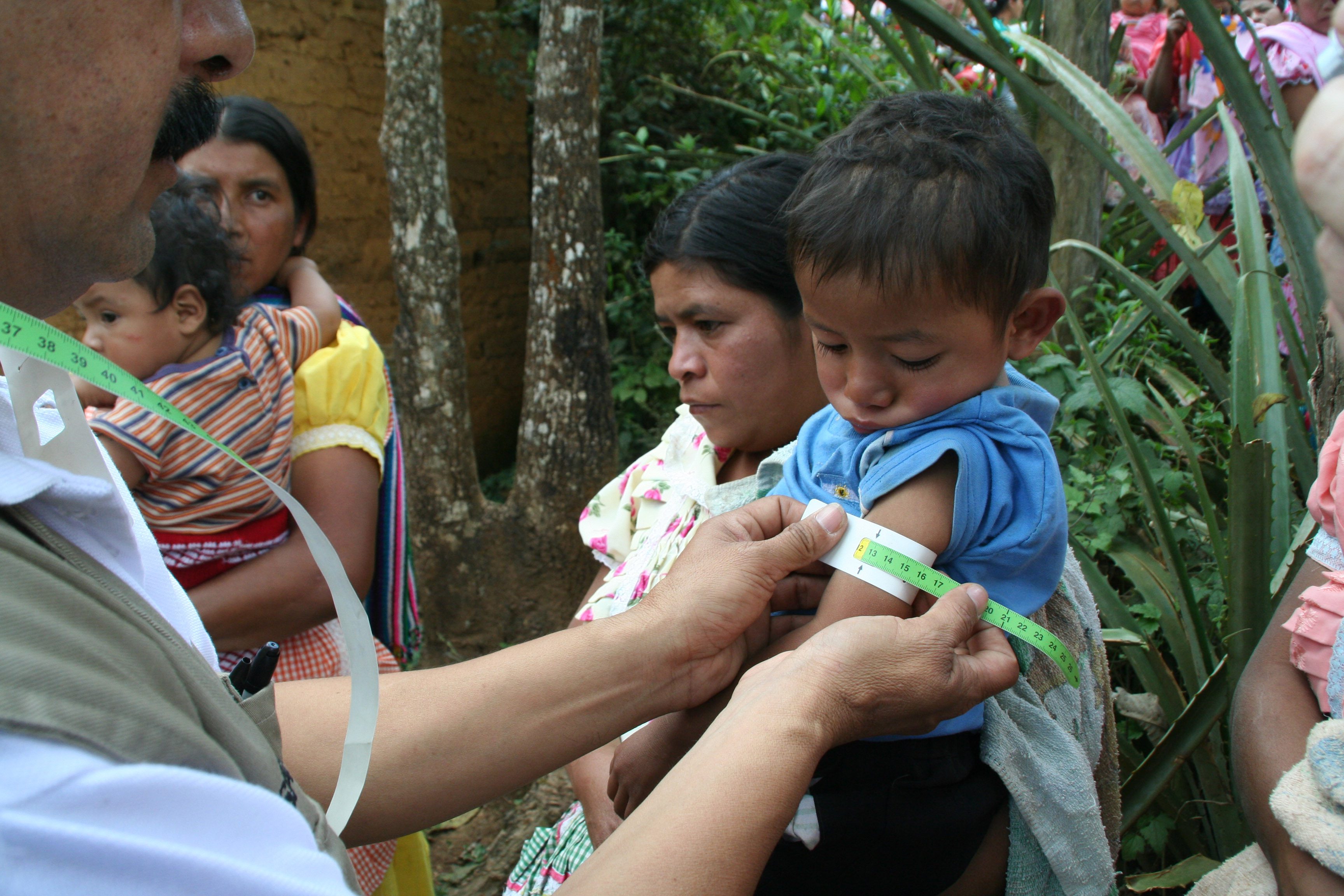 A child gets his arm circumference measured as part of Save the Children's growth monitoring program to check for malnourishment in Chiquimula, Guatemala.Todd Post/Bread for the World Institute.